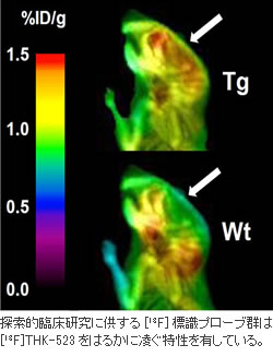 図1：脳内にタウ蛋白が蓄積するTgマウスおよび野生型（Wt）マウスに工藤教授らが見出したプロトタイプタウプローブ[18F]THK-523を静脈内投与した際の小動物用PET画像