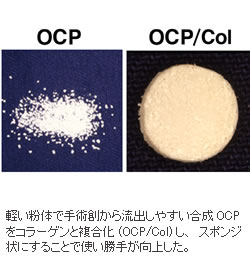 図１：OCP/Col作製による賦形性向上