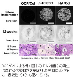 図２：OCP/Colの優位な骨再生能