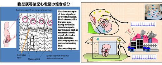 図1：胎児心電図開発の難しさ