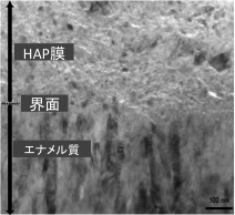 図1：エナメル質とHAP膜界面のTEM像　x250,000