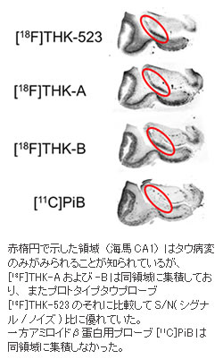 図2：アルツハイマー病患者脳切片におけるオートラジオグラフィ画像