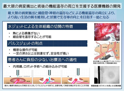 図1：パルスジェットメスの特徴