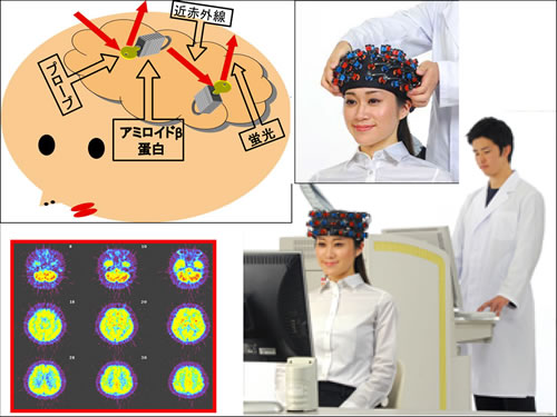 図1：研究テーマの概念、原理および実際の診断の想像図